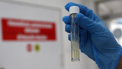 Dünyanın en ölümcül bulaşıcı hastalığı geçen yıl 1,23 milyon can aldı