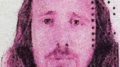 Saç ekimi ve diş tedavisi için Türkiye'ye geldi: İngiliz vatandaşı, hayatını kaybetti