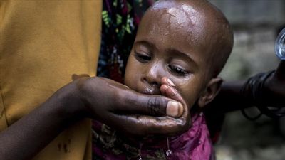 Afrika, 25 yılın en kötü kolera salgınıyla karşı karşıya