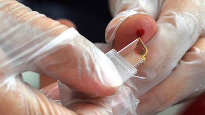 Yeni kan grubu üretiliyor: Sadece 50 kişide var