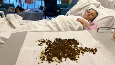 Manisa'da safra kesesinden 20 binin üzerinde taş çıktı