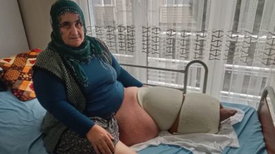 Mersin'de fil hastalığıyla mücadele ediyor