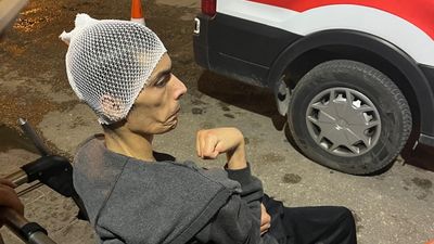 Gaziantep’te engelli bakım merkezinde şiddet: Gencin başına 6 dikiş atıldı