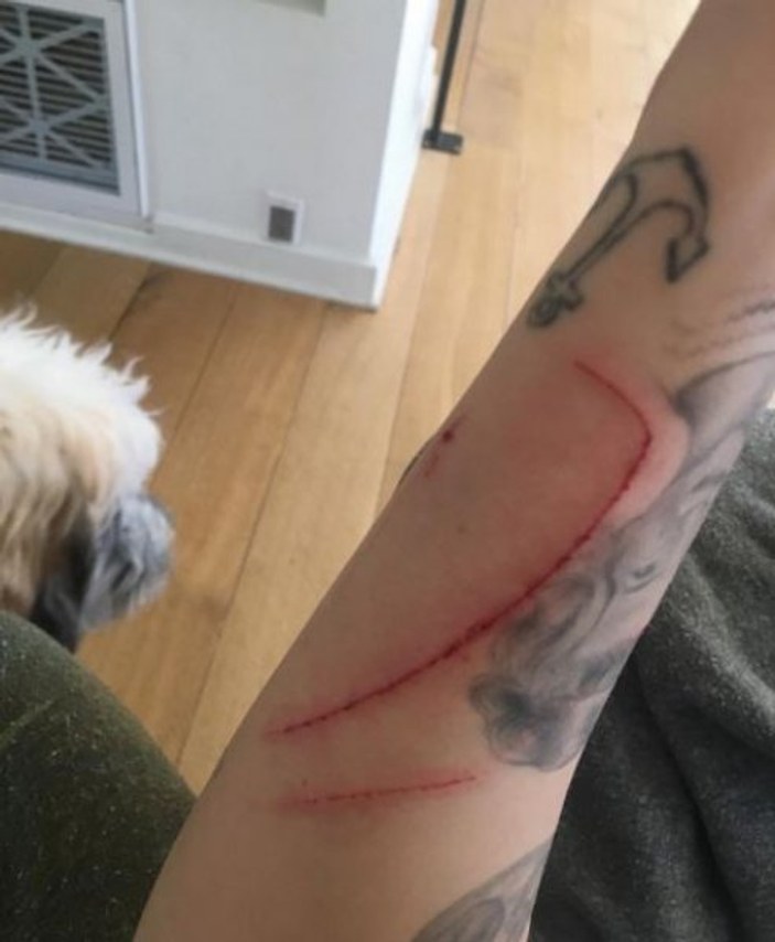 Miley Cyrus’a kedi saldırdı