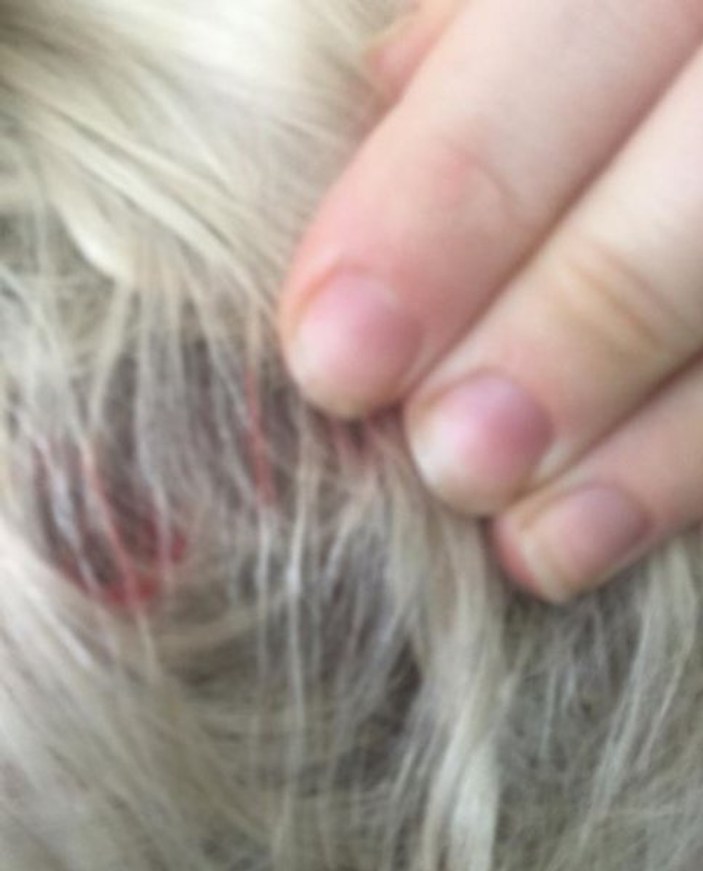 Miley Cyrus’a kedi saldırdı