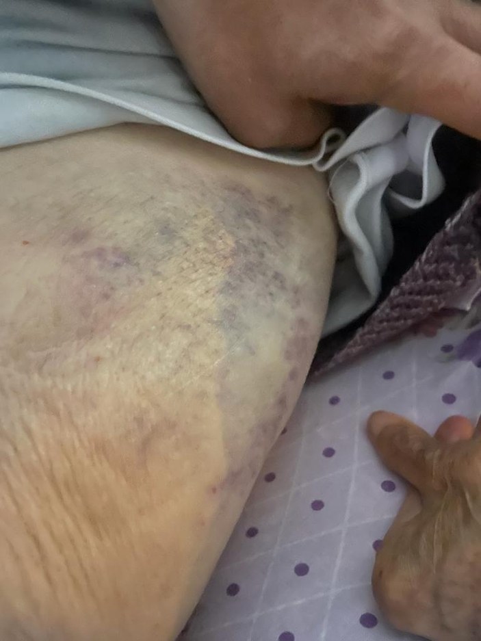 Ankara'da bakıcı dehşeti: 91 yaşındaki kadın hastaneye kaldırıldı - En Son  Haber