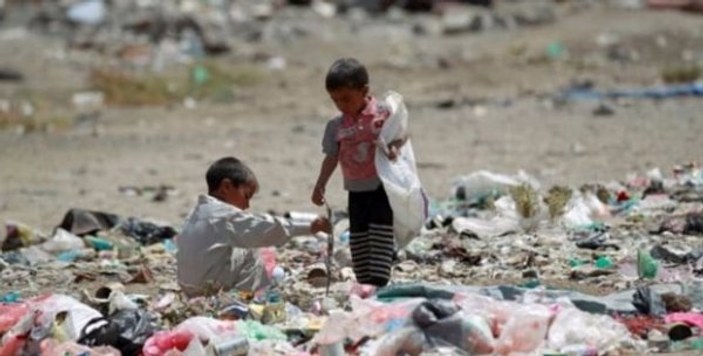 Yemen'de çocuklar açlıktan ölmeye devam ediyor