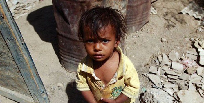 Yemen'de çocuklar açlıktan ölmeye devam ediyor