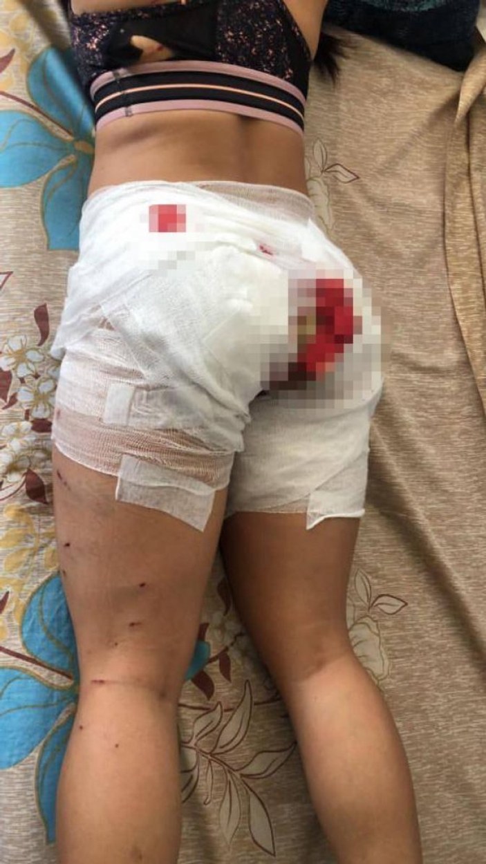 Antalya'da sokak köpeklerinin saldırdığı Endonezyalı kadın ağır yaralandı