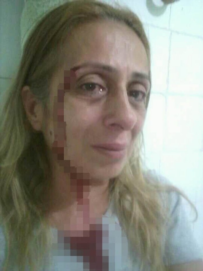 Adana'da bağımlı gençten ailesine şiddet