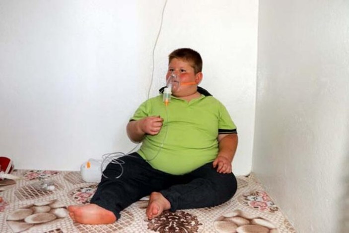 Gaziantep'te Prader Willi sendromlu küçük Mustafa, yardım bekliyor