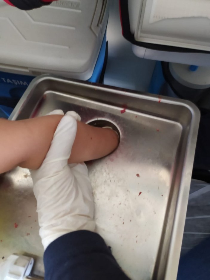 Nevşehir'de 4 yaşındaki çocuk elini kıyma makinesine kaptırdı