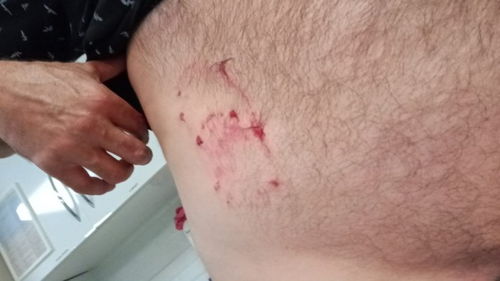 Zonguldak’ta sokak köpeklerini saldırısına uğrayan adam yaralandı