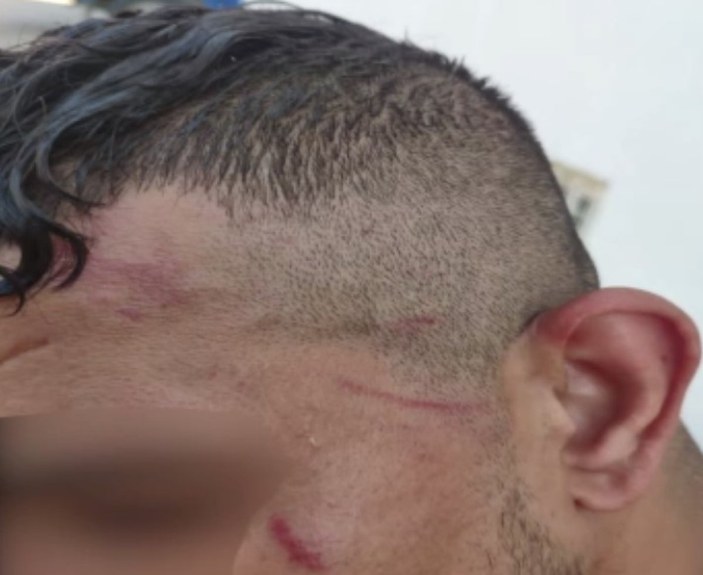 Yunan polisinden göçmenlere işkence: Önce dövdüler, sonra ölüme terk ettiler