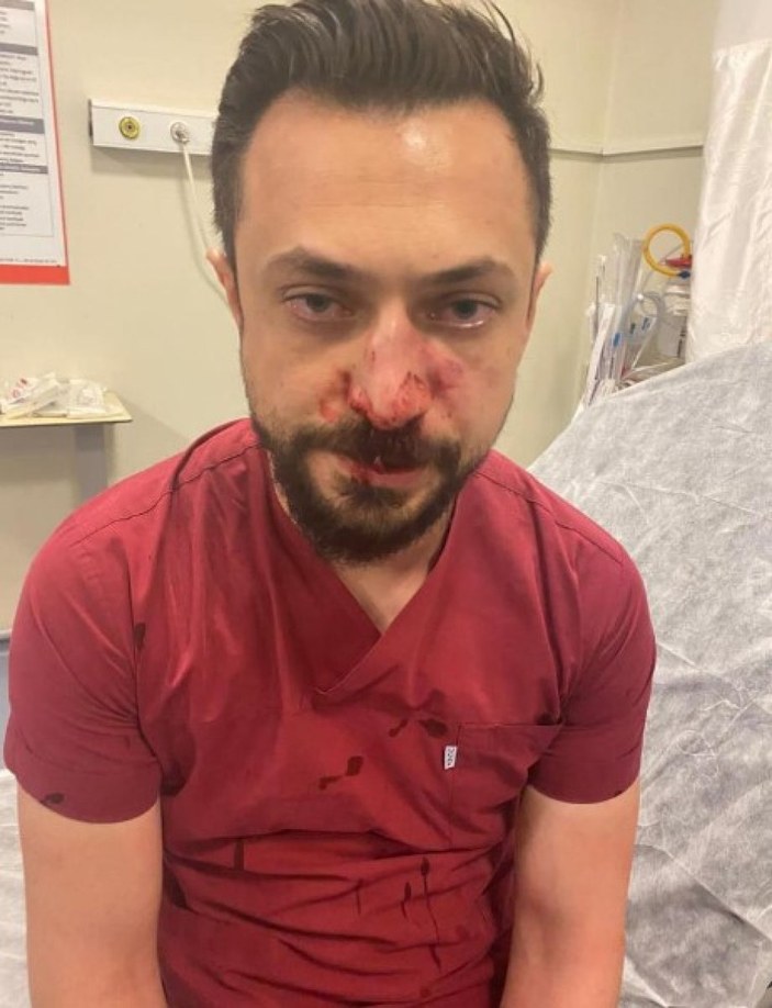 Şanlıurfa'da hasta yakını doktorun burnunu kırdı
