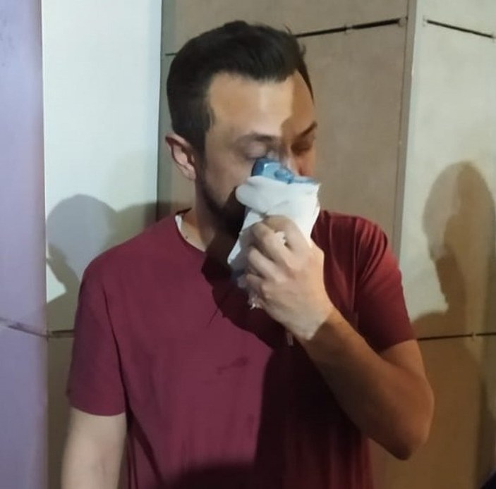 Şanlıurfa'da hasta yakını doktorun burnunu kırdı