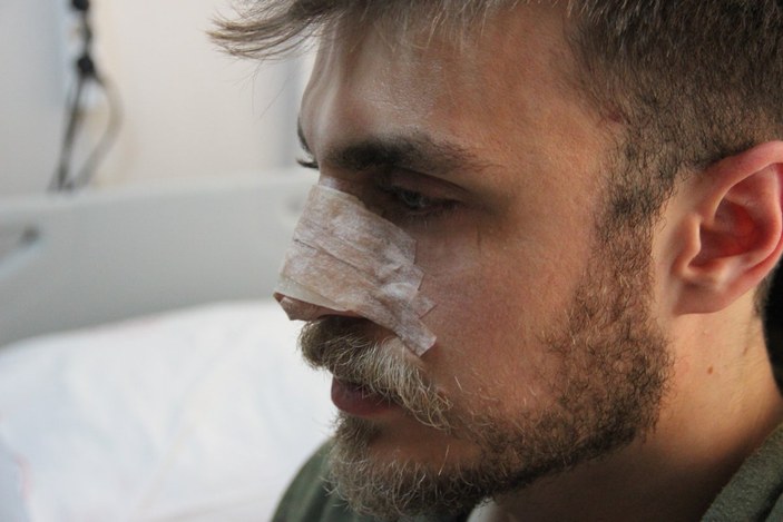 İzmir'de 'Eşimi nasıl muayene edersin' diyerek doktorun burnu kırdı