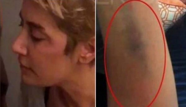 Sıla'nın Adli Tıp raporu