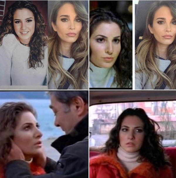 Rojda Demirer'den estetik açıklaması