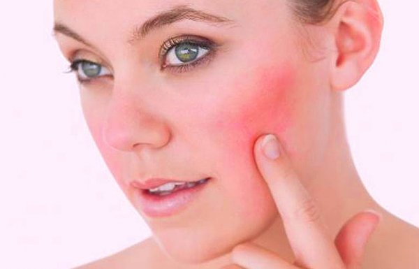 Yüzdeki değişiklikler hastalık belirtisi olabilir