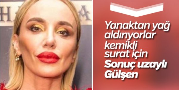 Hollywood yanağı nedir