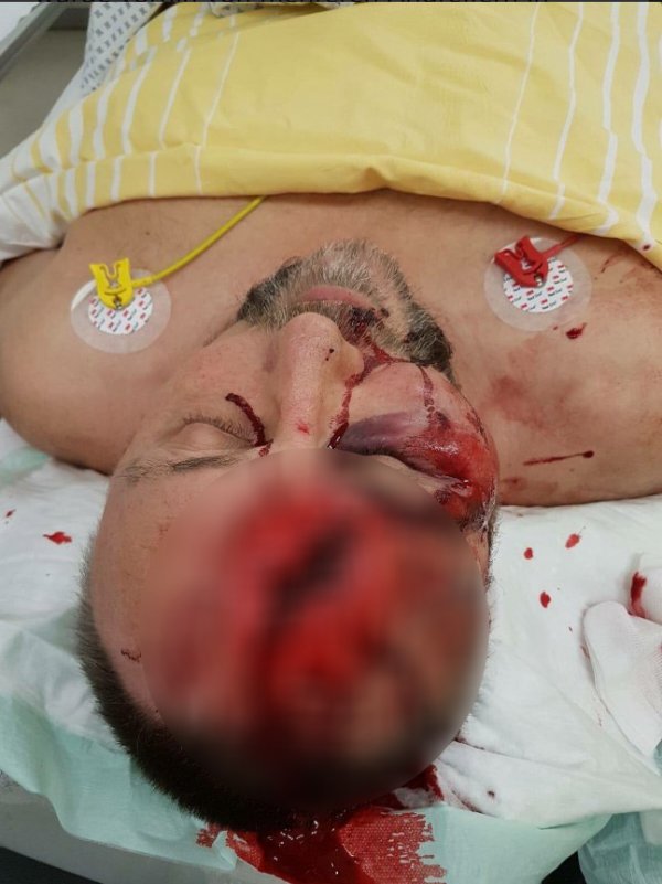 Almanya'da AfD milletvekili öldüresiye dövüldü