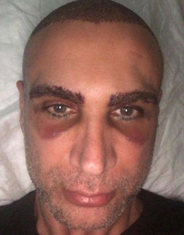 Doğuş hem kaşını hem saçını ektirdi