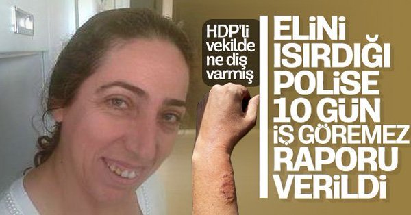 Polisi ısıran HDP'li vekilin düşme anı