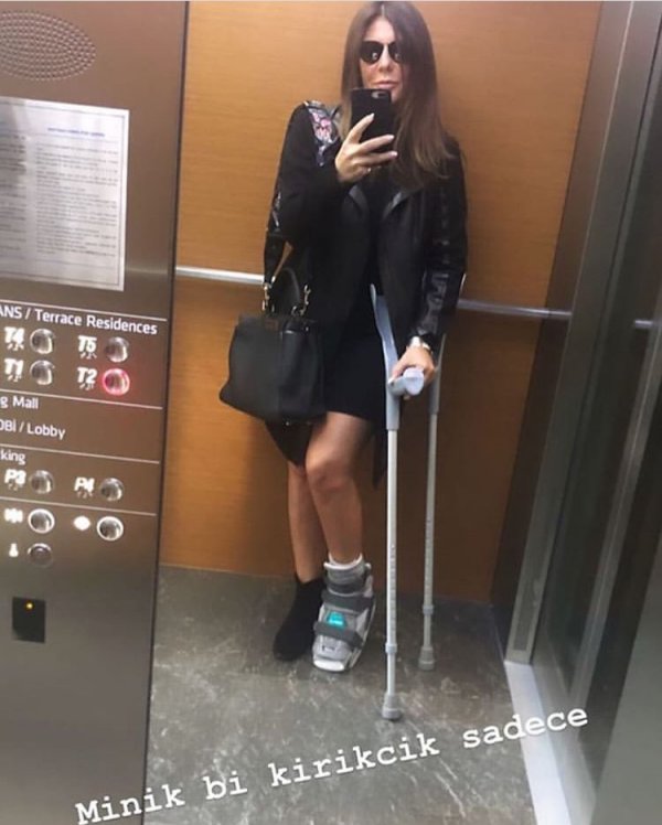 Zeynep Yılmaz kuboid kemiğini kırdı