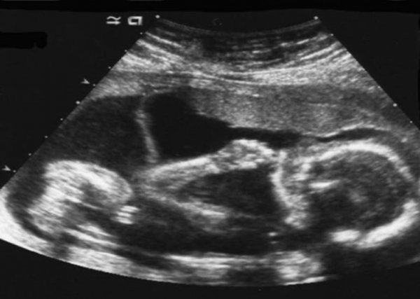 Süreyya Yalçın müjdeyi verdi