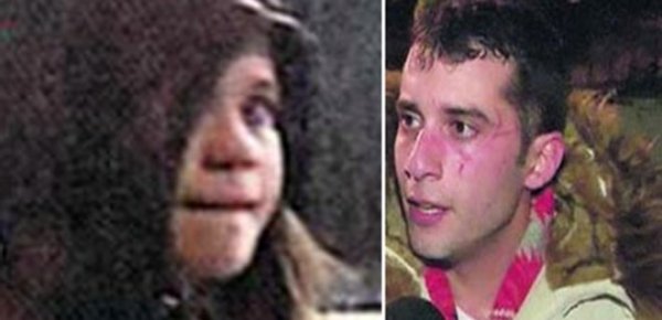 Fırat Altunmeşe dayak yediği sevgilisinden ayrılmadı