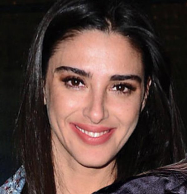 Aslıhan Doğan dudaklarına dolgu yaptırdı