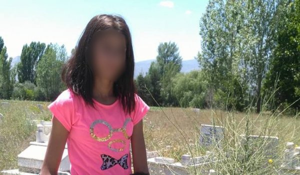 Lise öğrencisi bitlerden kurtulmak isterken tutuştu