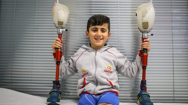 a Suriyeli sakat çocuklar, protez bacaklarıyla koşacak