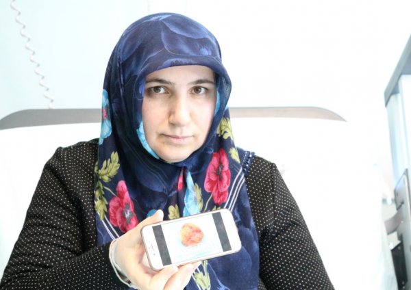 i Talihsiz kadının kalbinden kitle çıkarıldı