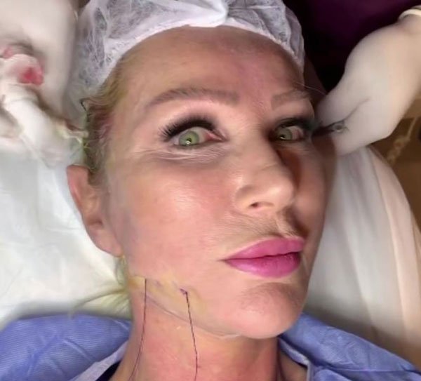 Seda Sayan canlı yayında estetik yaptırdı