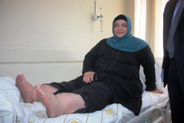 Zayıflamak isterken hayatından oluyordu