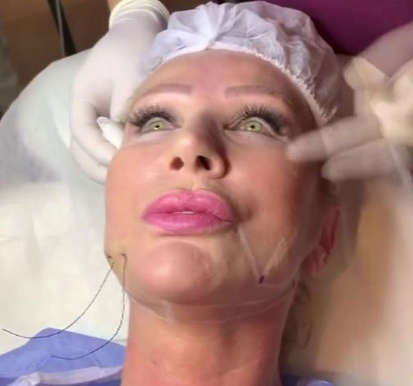 Seda Sayan canlı yayında estetik yaptırdı