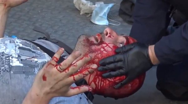 Fransız polisi göstericinin kafasını jopladı