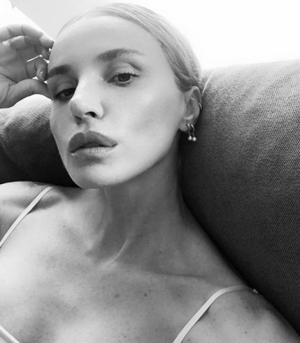 Gülşen: Dolgu yaptırıp da yakışanını görmedim