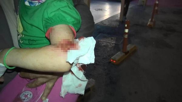 d Esenyurt'ta pitbull dehşeti kamerada