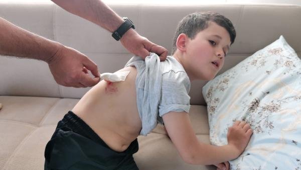 Bursa'da 9 yaşındaki çocuğa sokak köpekleri saldırdı