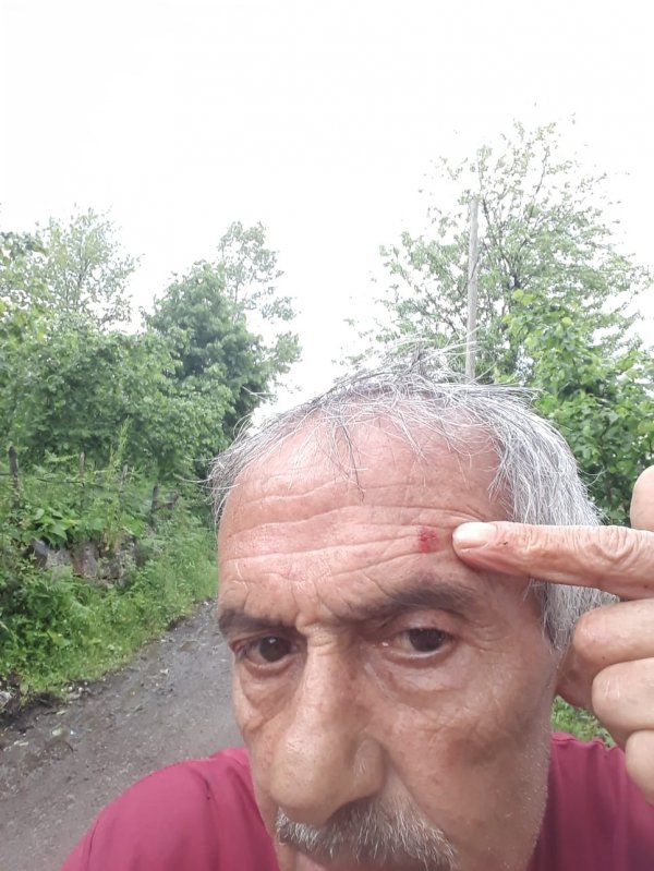 Ceviz büyüklüğünde yağan dolu fındığa zarar verdi