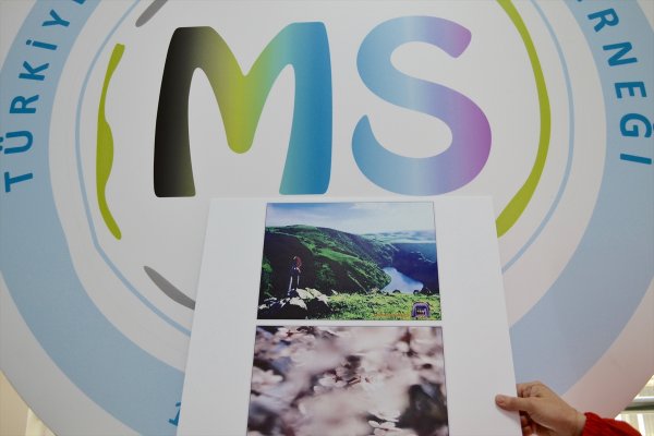 Fotoğraflarla MS hastalarının 'flu dünyaları'