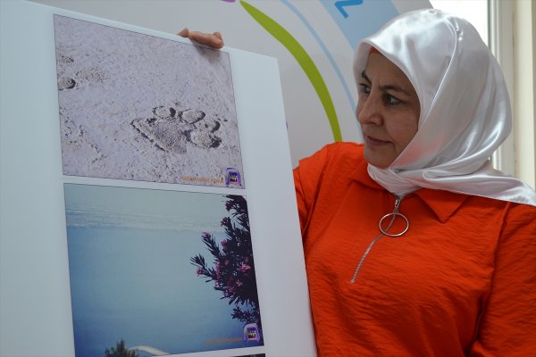 Fotoğraflarla MS hastalarının 'flu dünyaları'