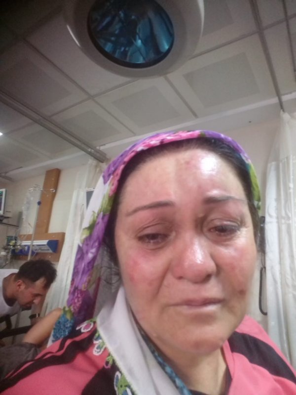 Evi terk eden karısının ailesini de darbetti