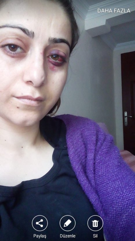 Evi terk eden karısının ailesini de darbetti