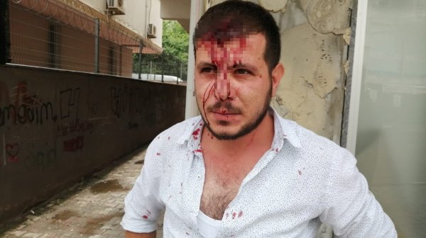 i Borcunu almaya gitti, iki kişinin taşla saldırısına uğradı