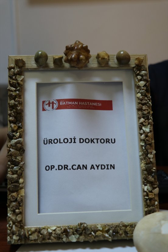 a Hastalarından çıkardığı taşları koleksiyon yaptı