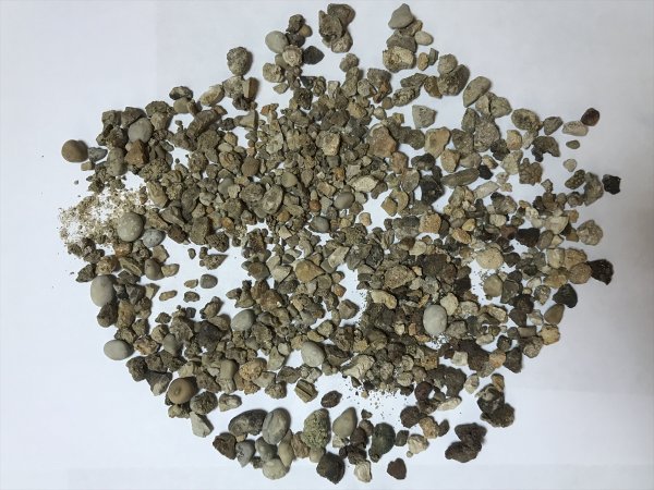 a Hastalarından çıkardığı taşları koleksiyon yaptı